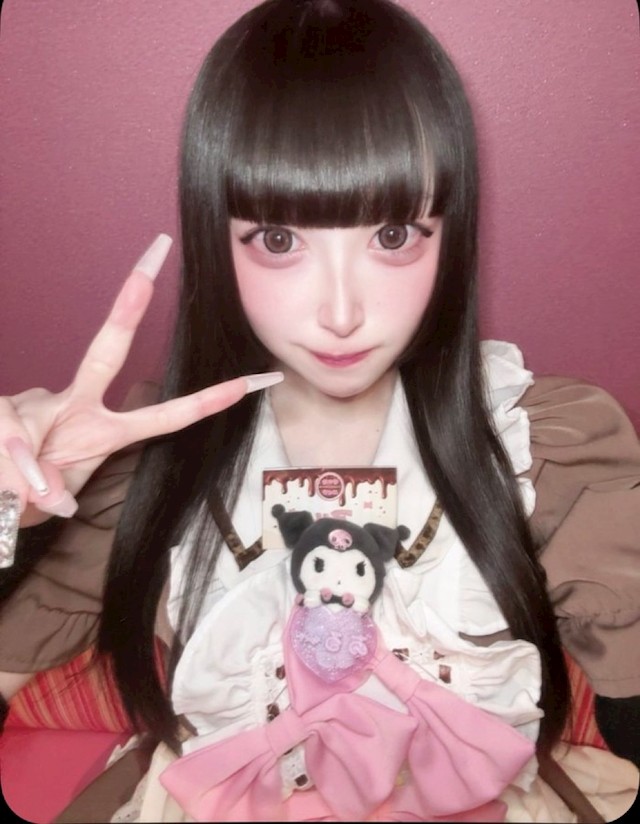 アルプロフィール写真13